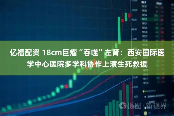 亿福配资 18cm巨瘤“吞噬”左肾:西安国际医学中心医院多学科协作上演生死救援